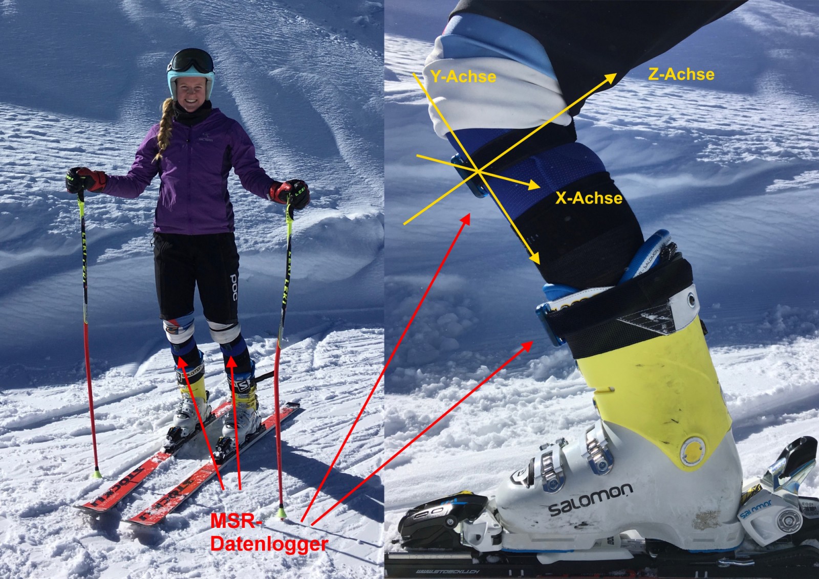 Links: Position der Datenlogger am Knie der Skirennfahrerin, beidseitig. Rechts: Detailansicht Position der MSR Datenlogger. Quelle: Thea Waldleben